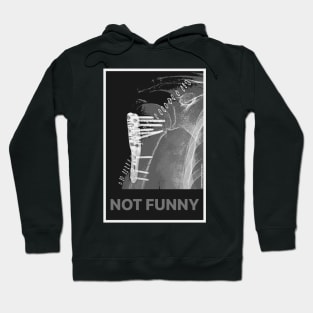 Not Funny But Humerus X-Ray Black Hoodie